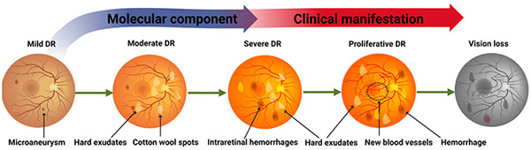 DR stages